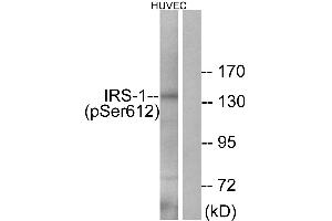 Western blot analysis of extracts from HUVEC cells, treated with insulin (0. (IRS1 Antikörper  (pSer612))