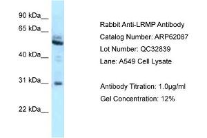 Western Blotting (WB) image for anti-Lymphoid-Restricted Membrane Protein (LRMP) (C-Term) antibody (ABIN2789013) (LRMP Antikörper  (C-Term))