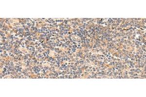 Immunohistochemistry of paraffin-embedded Human tonsil tissue using TEAD3 Polyclonal Antibody at dilution of 1:50(x200) (TEAD3 Antikörper)