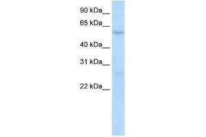 WB Suggested Anti-HIC2 Antibody Titration:  0. (HIC2 Antikörper  (N-Term))