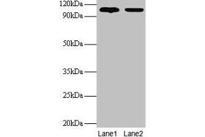 Western blot All lanes: EXTL3 antibody at 2 μg/mL Lane 1: EC109 whole cell lysate Lane 2: 293T whole cell lysate Secondary Goat polyclonal to rabbit IgG at 1/15000 dilution Predicted bane side: 105 kDa Observed band side: 105 kDa (EXTL3 Antikörper  (AA 2-245))