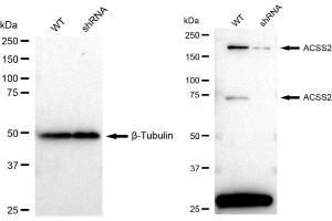 Western blotting analysis using ACSS2 antibody (ABIN7797499).