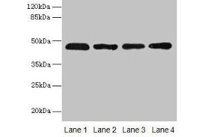 Western blot All lanes: ZDHHC23 antibody at 8 μg/mL Lane 1: 293T whole cell lysate Lane 2: Mouse brain tissue Lane 3: A549 whole cell lysate Lane 4: Human placenta tissue Secondary Goat polyclonal to rabbit IgG at 1/10000 dilution Predicted band size: 46 kDa Observed band size: 46 kDa (ZDHHC23 Antikörper  (AA 187-302))