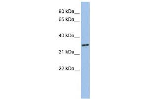 Western Blotting (WB) image for anti-PHD Finger Protein 13 (PHF13) antibody (ABIN2459472)