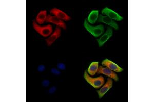 ABIN7094421 and ABIN7098468 staining Hela cells by IF/ICC.