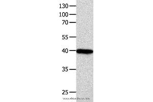 Western blot analysis of 293T cell  , using FOXL1  Polyclonal Antibody at dilution of 1:850 (FOXL1 Antikörper)