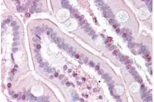 Human Small Intestine (formalin-fixed, paraffin-embedded) stained with RTEL1 antibody ABIN334244 at 5 ug/ml followed by biotinylated goat anti-rabbit IgG secondary antibody ABIN481713, alkaline phosphatase-streptavidin and chromogen. (RTEL1 Antikörper  (N-Term))