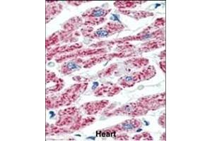 Formalin-fixed and paraffin-embedded human Heart tissue reacted with ACO2 Antibody (Center) (ABIN388648 and ABIN2838363) , which was peroxidase-conjugated to the secondary antibody, followed by AEC staining. (ACO2 Antikörper  (AA 438-467))