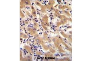 F11 Antibody (Center) (ABIN655515 and ABIN2845030) immunohistochemistry analysis in formalin fixed and paraffin embedded human liver tissue followed by peroxidase conjugation of the secondary antibody and DAB staining. (Factor XI Antikörper  (AA 281-307))