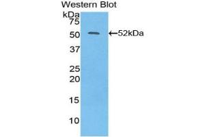 Detection of Recombinant IFNb, Human using Polyclonal Antibody to Interferon Beta (IFNb) (IFNB1 Antikörper  (AA 22-187))