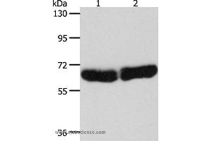 Western blot analysis of Human fetal liver and brain tissue, using CYP1B1 Polyclonal Antibody at dilution of 1:250