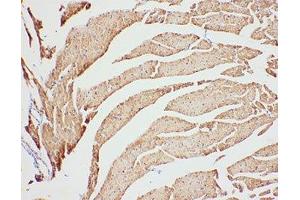 IHC-P: VDAC1 antibody testing of rat heart tissue (VDAC1 Antikörper  (Middle Region))