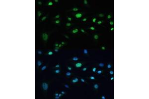 Immunofluorescence analysis of U-2 OS cells using MDC1 antibody (ABIN6131721, ABIN6143660, ABIN6143662 and ABIN6224387) at dilution of 1:100. (MDC1 Antikörper  (AA 1-350))