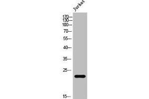 Western Blot analysis of Jurkat cells using AKAP 14 Polyclonal Antibody (AKAP14 Antikörper  (N-Term))