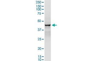 ADH1C (Human) IP-WB Antibody Pair