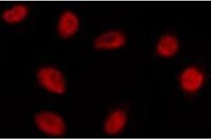 ABIN6275189 staining HepG2 by IF/ICC. (EMX1 Antikörper  (Internal Region))