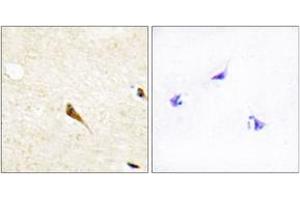 Immunohistochemistry analysis of paraffin-embedded human brain tissue, using MOK Antibody. (MOK Antikörper  (AA 261-310))