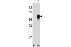 Western Blotting (WB) image for anti-Plasminogen Activator, Urokinase Receptor (PLAUR) antibody (ABIN3003728) (PLAUR Antikörper)