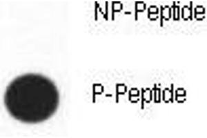 Dot blot analysis of phospho-CDX2 antibody. (CDX2 Antikörper  (pSer283))