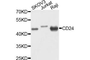 Western blot analysis of extracts of various cells, using CD24 antibody. (CD24 Antikörper)