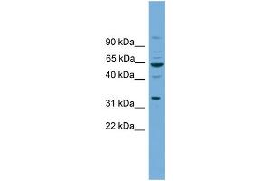 Western Blotting (WB) image for anti-Wingless-Type MMTV Integration Site Family, Member 8B (WNT8B) (N-Term) antibody (ABIN2787546)