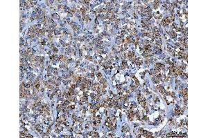 IHC analysis of CAD using anti-CAD antibody (ABIN7600044).