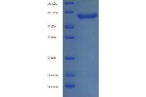 SDS-PAGE (SDS) image for Neurofilament, Light Polypeptide (NEFL) (AA 2-543) protein (His tag) (ABIN5713696) (NEFL Protein (AA 2-543) (His tag))