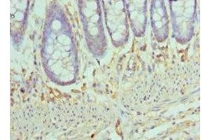 Immunohistochemistry of paraffin-embedded human colon tissue using ABIN7145996 at dilution of 1:100 (CCL28 Antikörper  (AA 20-127))