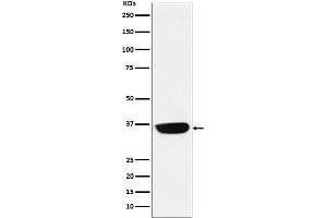 Western blot analysis of PHOX2B expression in Neuro-2a cell lysate.