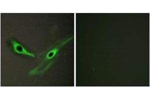 Immunofluorescence analysis of HeLa cells, using ICK Antibody. (ICK Antikörper  (AA 241-290))