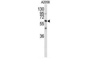 Western blot analysis of CNTN1 Antibody (Center) in A2058 cell line lysates (35µg/lane).