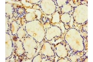 Immunohistochemistry of paraffin-embedded human thyroid tissue using ABIN7155301 at dilution of 1:100