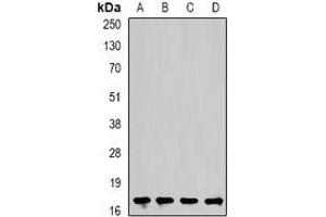 Western blot analysis of Cofilin 2 expression in Hela (A), mouse heart (B), rat kidney (C), rat brain (D) whole cell lysates. (Cofilin 2 Antikörper)