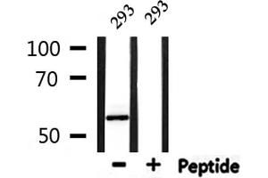 Western blot analysis of extracts from 293, using PFKFB1/4 Antibody.