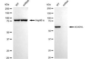Western blotting analysis using ACADVL antibody (ABIN7797496).