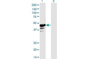Western Blot analysis of NAPRT1 expression in transfected 293T cell line by NAPRT1 monoclonal antibody (M01), clone 4A9.