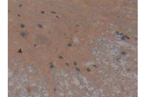 Immunohistochemistry (IHC) image for anti-Ring Finger Protein 112 (RNF112) (AA 256-504) antibody (ABIN7442381)