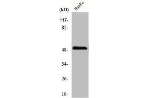 Western Blot analysis of HuvEc cells using IP3KA Polyclonal Antibody (ITPKA Antikörper  (C-Term))