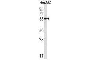 UGDH Antibody (C-term) western blot analysis in HepG2 cell line lysates (35 µg/lane).