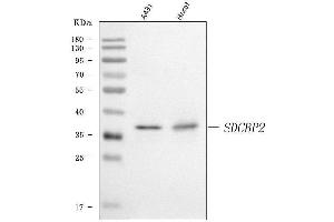 Western blot analysis of Syntenin 2/SDCBP2 using anti-Syntenin 2/SDCBP2 antibody (ABIN7600017). (SDCBP2 Antikörper  (AA 14-292))