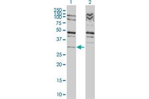 Western Blot analysis of TP53RK expression in transfected 293T cell line by TP53RK monoclonal antibody (M01), clone 4B9-1H3. (TP53RK Antikörper  (AA 1-253))