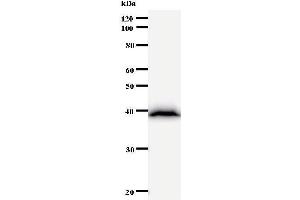 Western Blotting (WB) image for anti-Bromodomain Adjacent To Zinc Finger Domain, 1B (BAZ1B) antibody (ABIN930943) (BAZ1B Antikörper)