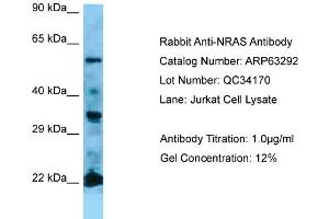 Western Blotting (WB) image for anti-GTPase NRas (NRAS) (Middle Region) antibody (ABIN2789436) (GTPase NRas Antikörper  (Middle Region))
