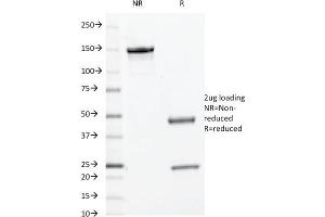 SDS-PAGE Analysis Purified c-Myc Mouse Monoclonal Antibody (9E10. (Myc Tag Antikörper  (C-Term))