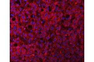 IF analysis of RAB3GAP1 using anti-RAB3GAP1 antibody (ABIN7599702). (RAB3GAP1 Antikörper  (AA 109-810))