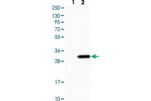 Western blot analysis of Lane 1: Human cell line RT-4 Lane 2: Human cell line U-251MG sp with RPL8 polyclonal antibody  at 1:500-1:1000 dilution. (RPL8 Antikörper)
