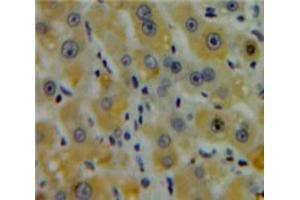 Used in DAB staining on fromalin fixed paraffin-embedded Liver tissue (CENPE Antikörper  (AA 2450-2590))