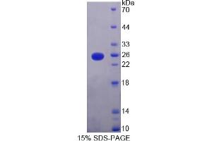 Image no. 1 for GTPase Kras (KRAS) (AA 1-189) protein (His tag) (ABIN6237562) (K-RAS Protein (AA 1-189) (His tag))
