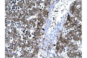 MMP19 antibody was used for immunohistochemistry at a concentration of 4-8 ug/ml to stain Hepatocytes (arrows) in Human Liver. (MMP19 Antikörper  (C-Term))
