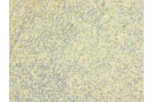 Immunohistochemistry (IHC) image for anti-Protein tyrosine Phosphatase, Receptor Type, J (PTPRJ) (AA 140-370) antibody (ABIN7167504)